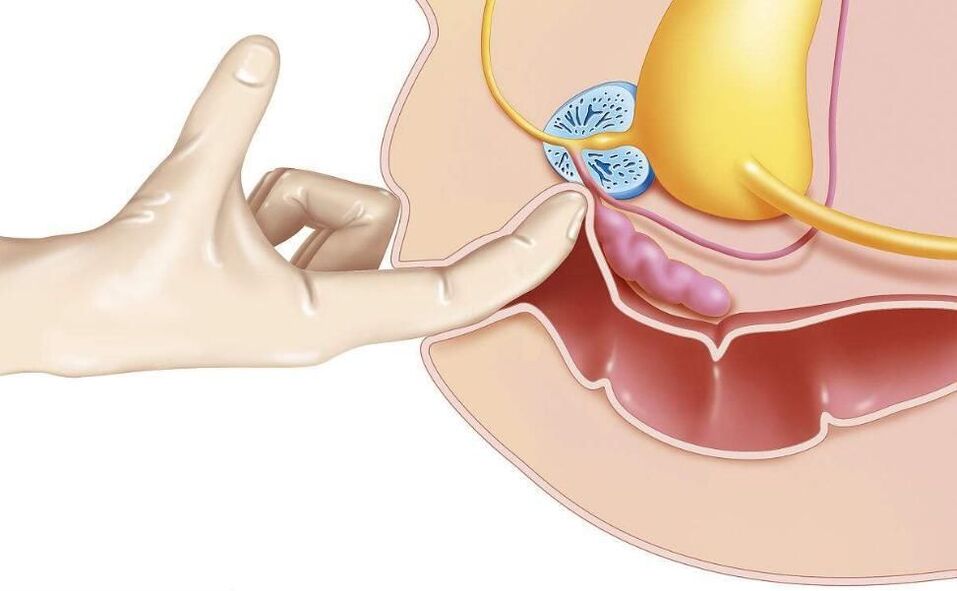 Prostate Massage for Prostatitis